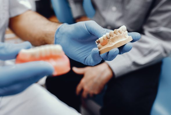 Os principais cuidados na manutenção de implantes dentários