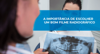 A importância de escolher um bom filme radiográfico