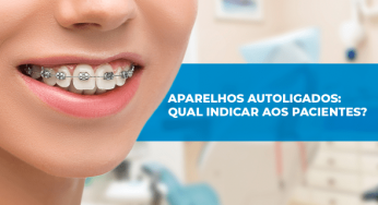 Aparelhos autoligados: qual indicar aos pacientes?