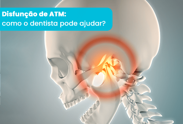 Disfunção de ATM: como o dentista pode ajudar?