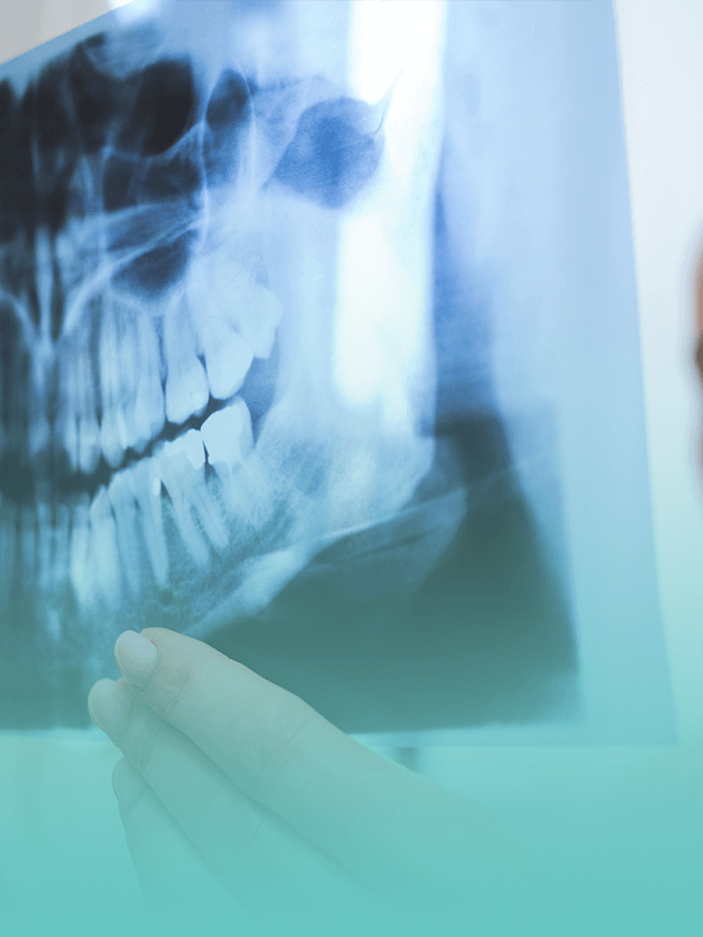 Osteotomia: conheça o procedimento na odontologia