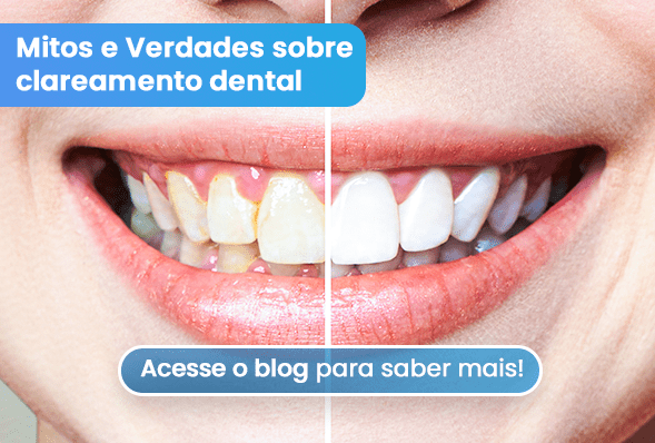 Desvendando mitos sobre clareamento dental: Um sorriso mais brilhante ao alcance de todos