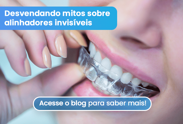 Alinhador invisível mitos e verdades! – Nunes Odontologia – Belo Horizonte