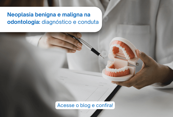 Neoplasia benigna e maligna na odontologia: diagnóstico e conduta