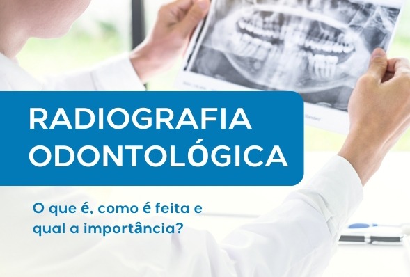 Radiografia odontológica: o que é, como é feita e qual a importância?