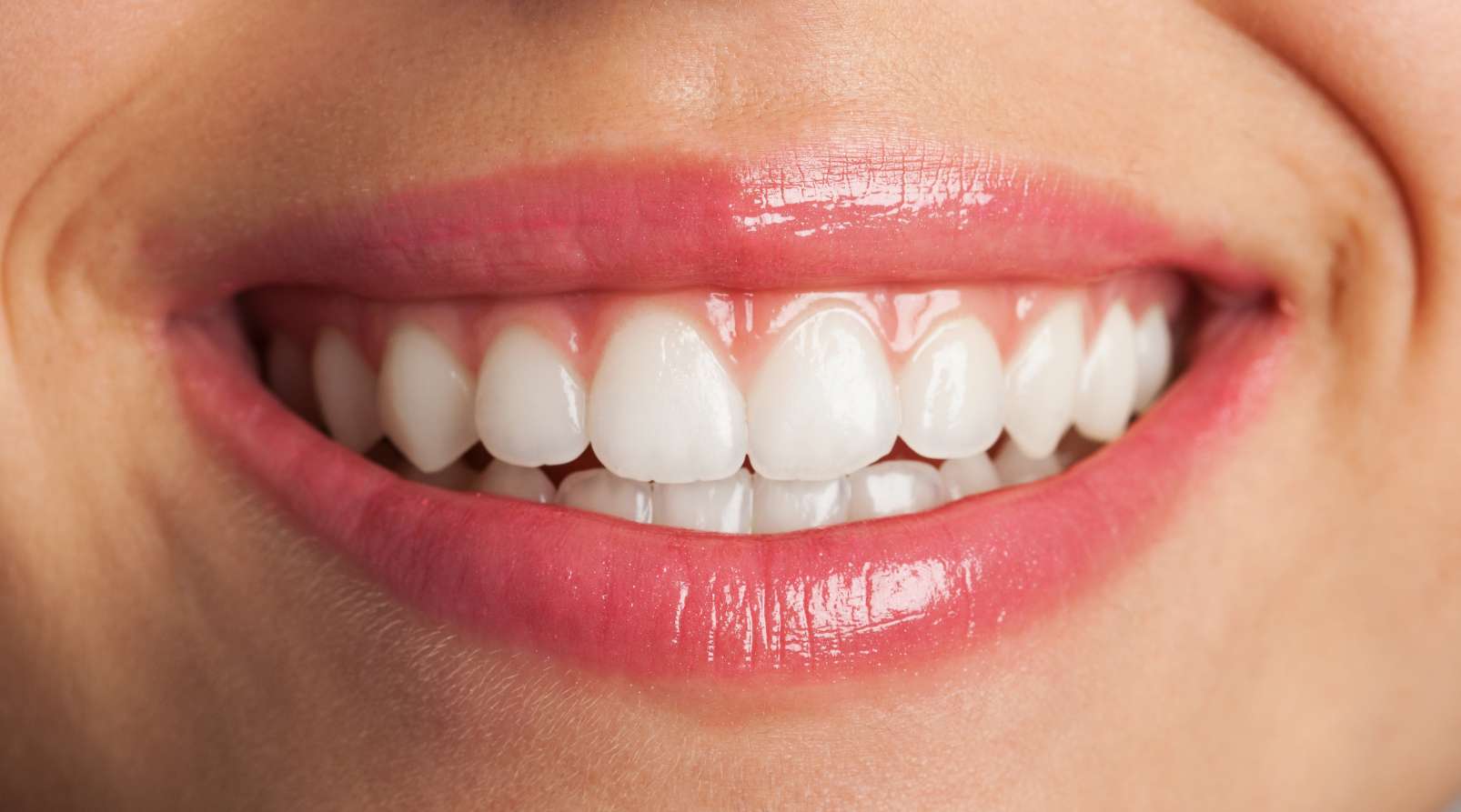 Clareamento Dental em Consultório: Saiba Alguns Detalhes